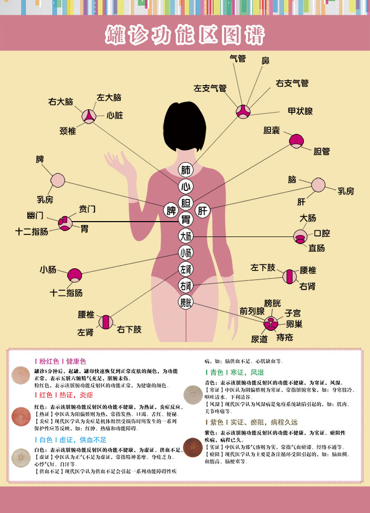 扶阳罐印对应症状图片