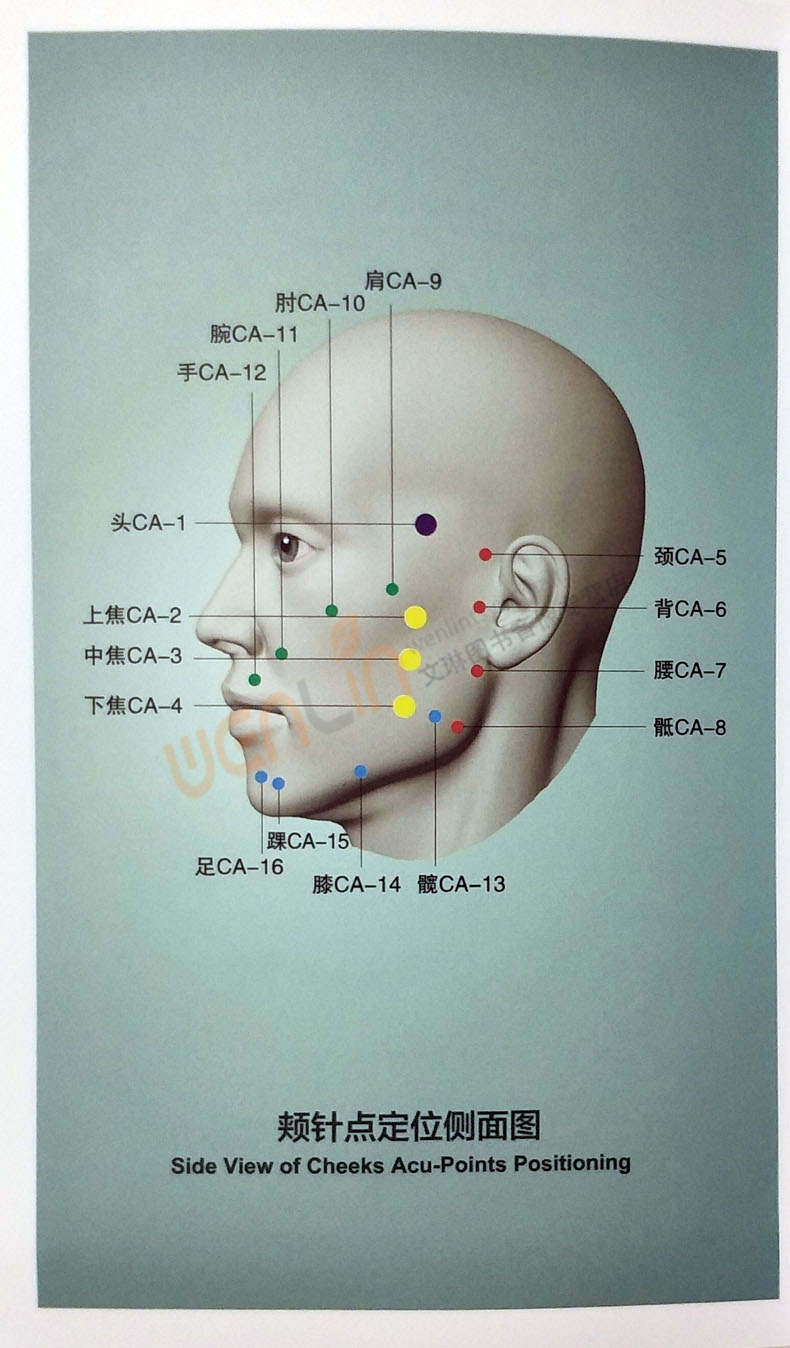 口针疗法图解图片