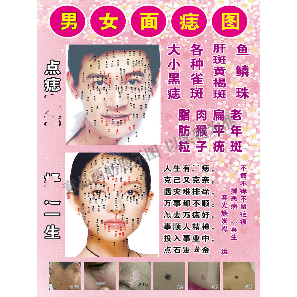 广告面部祛痣激光光点海报男女面痣pp贴纸写真