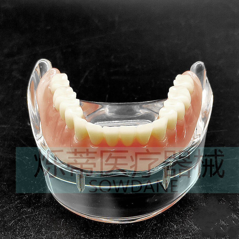 牙科教学模型种植模型2钉下颌医患沟通透明分解模型齿科牙模