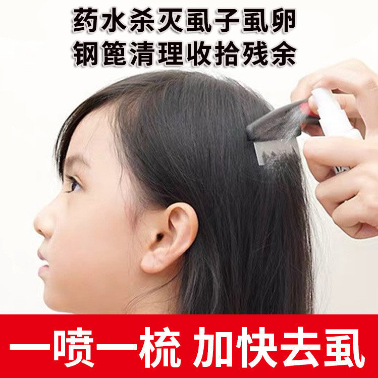 灭杀驱祛头虱儿童小孩头上长虱子药大人女孩头发除一扫光家用人用