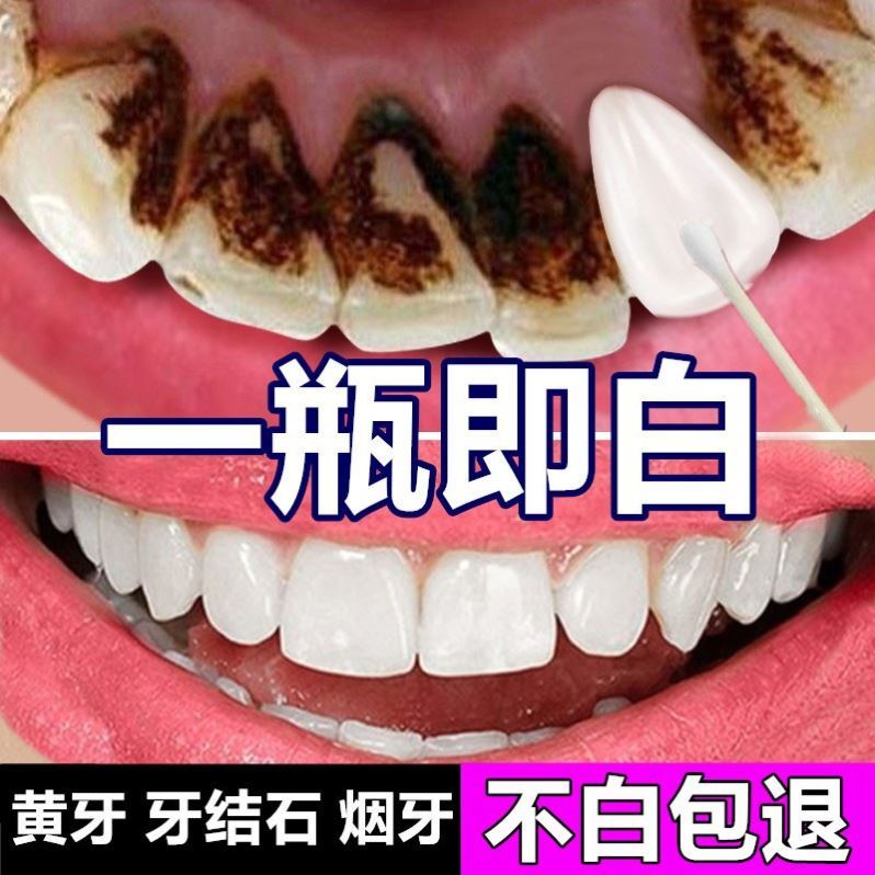 牙菌斑去掉图片