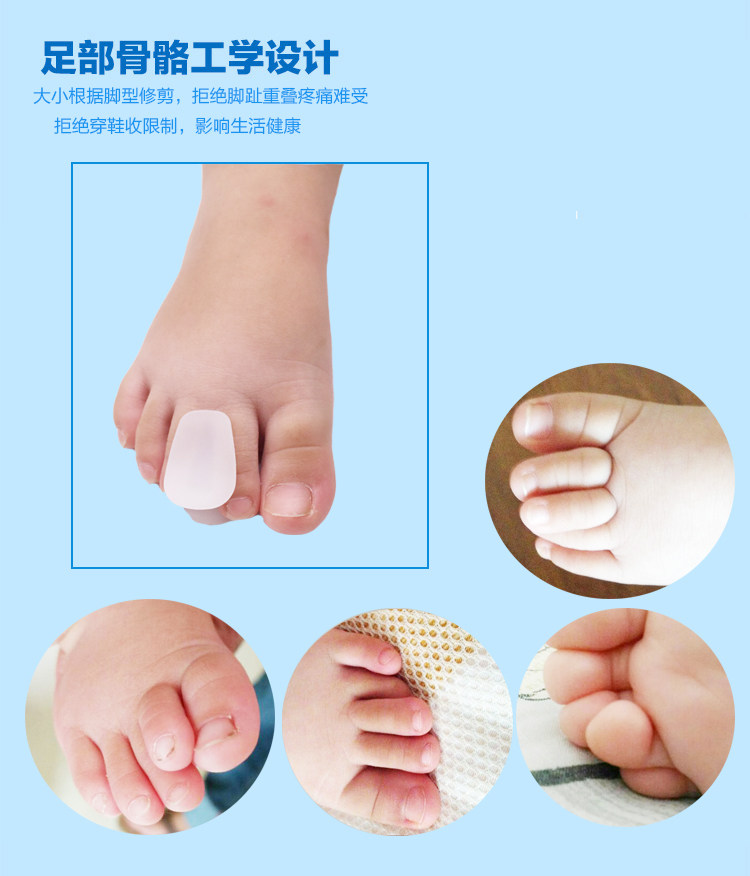 脚趾矫正儿童宝宝分离器重叠内扣外翻腿部防护用品