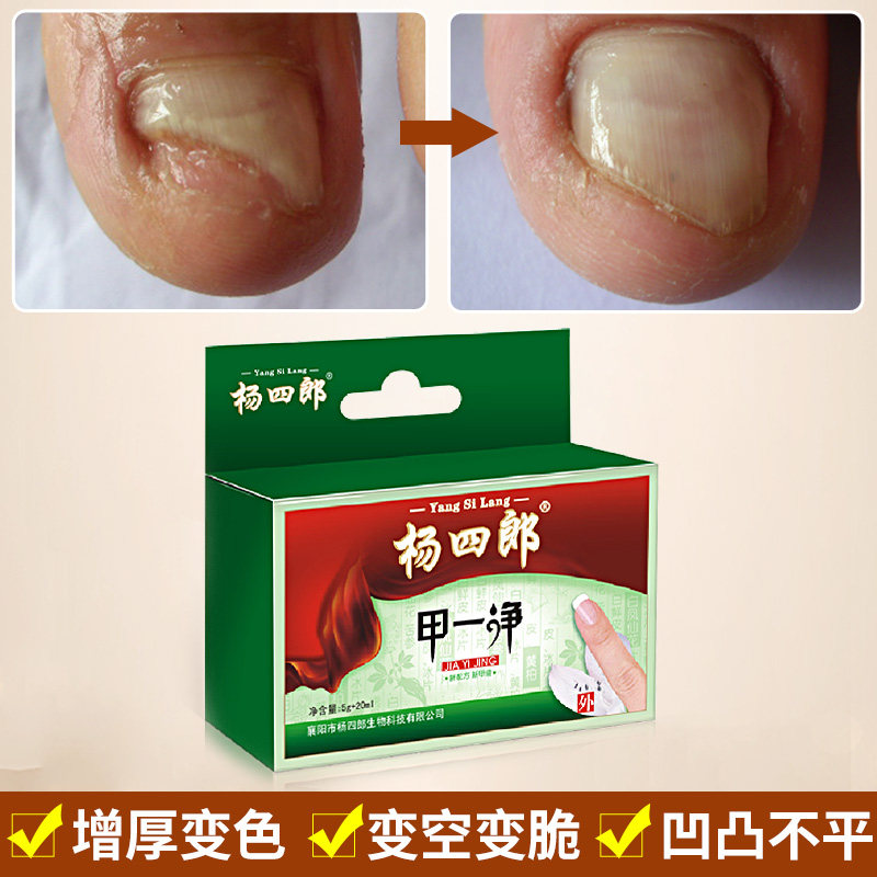 杨四郎灰指甲药膏专用软甲外用增厚脚趾甲变厚冰醋酸保健理疗