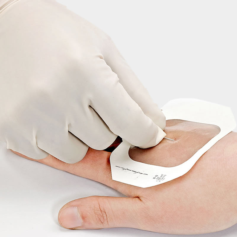 弘生留置贴膜胰岛素剖腹产防水picc中心静脉导管伤口敷料