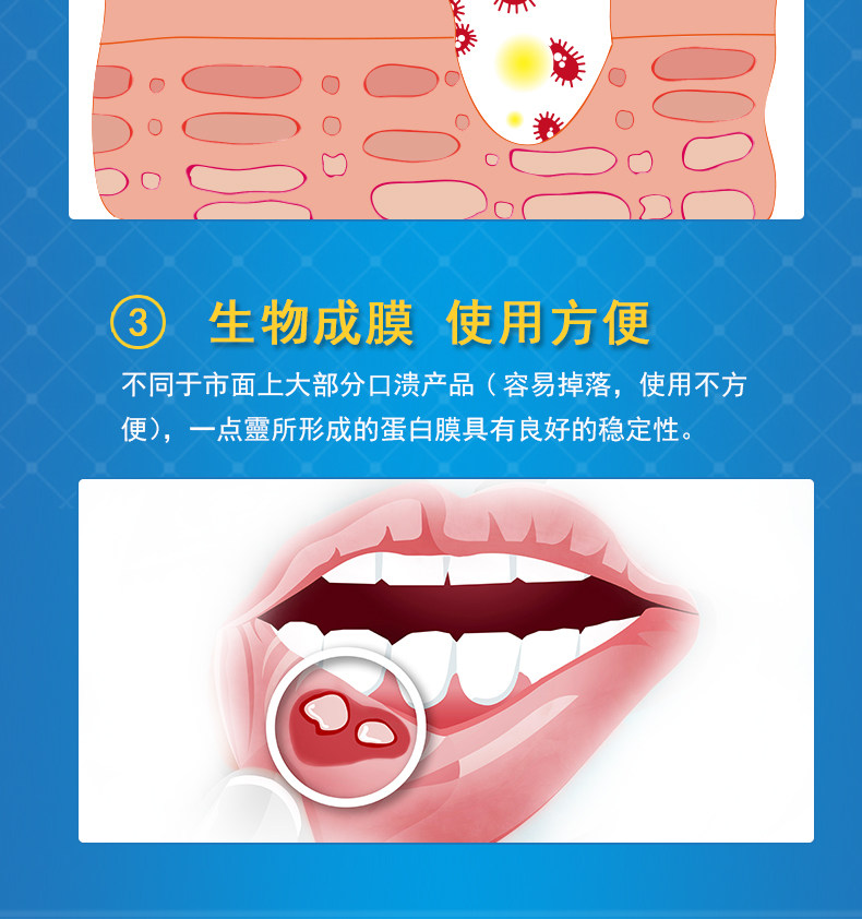 牙得安新一一点灵15ml送涂药棒口腔黏膜上火起泡口鼻清洁杀菌消炎剂
