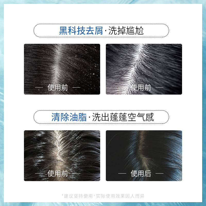 nelly洗发水去屑止痒控油洗发露洗头膏