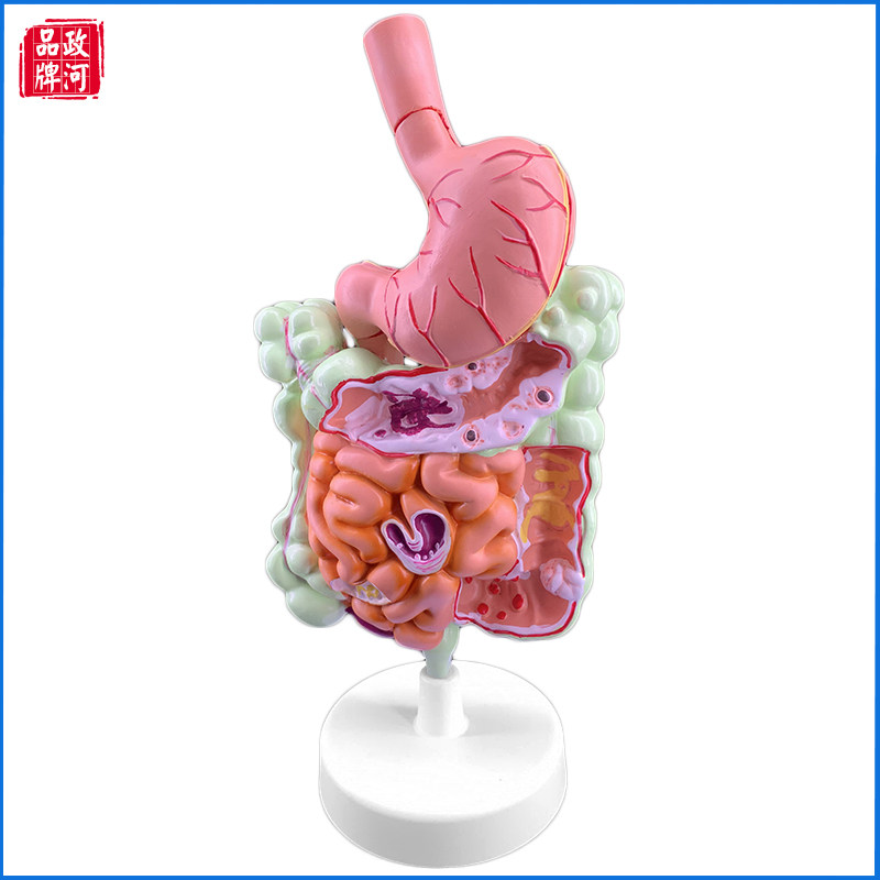 模型人体解剖大肠病理器官医院用教学成消化系统其他模型玩具
