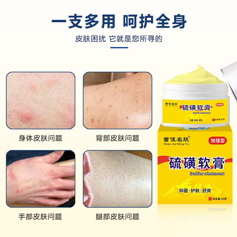 硫磺皮肤软膏阴虱疥虫复方乳膏外用抑菌止痒皮肤消毒护理消
