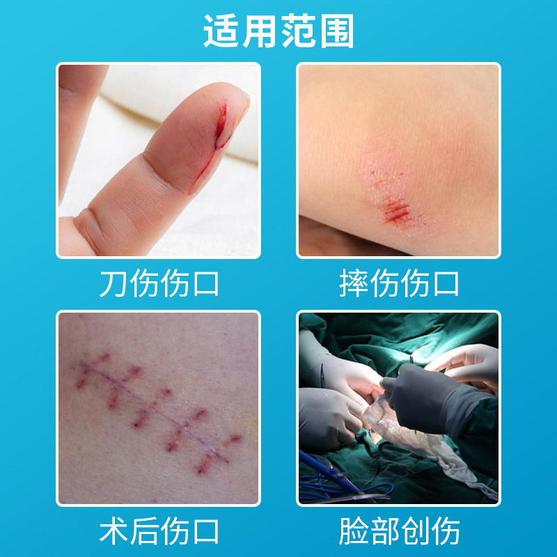 医用张贴减张皮肤疤痕预防贴减拉链伤口缝合创口贴