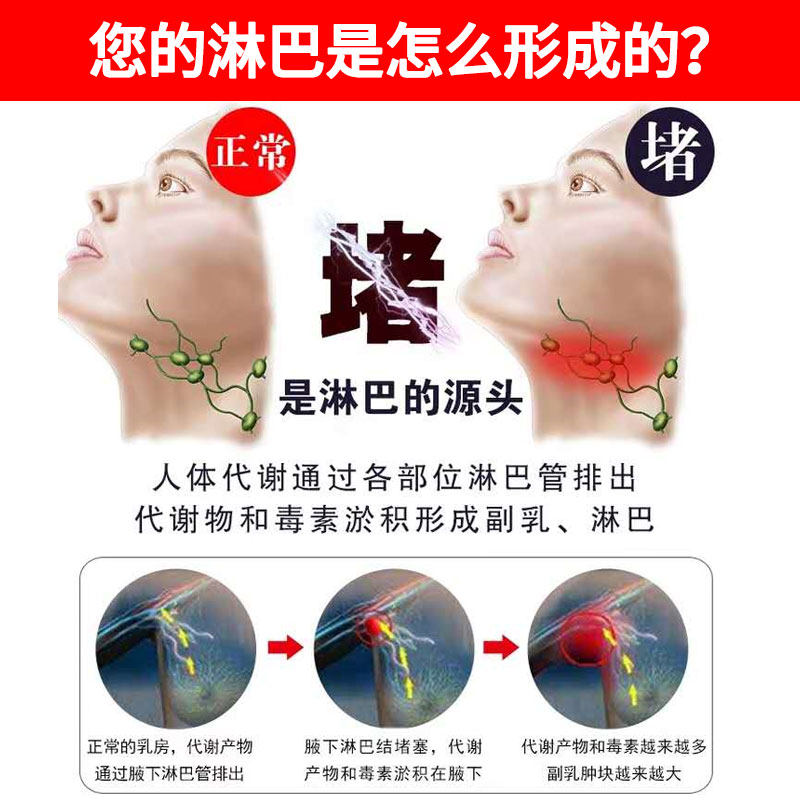 淋巴结消贴颈部腋窝肿大散结疏通副乳消除神器膏药贴器械