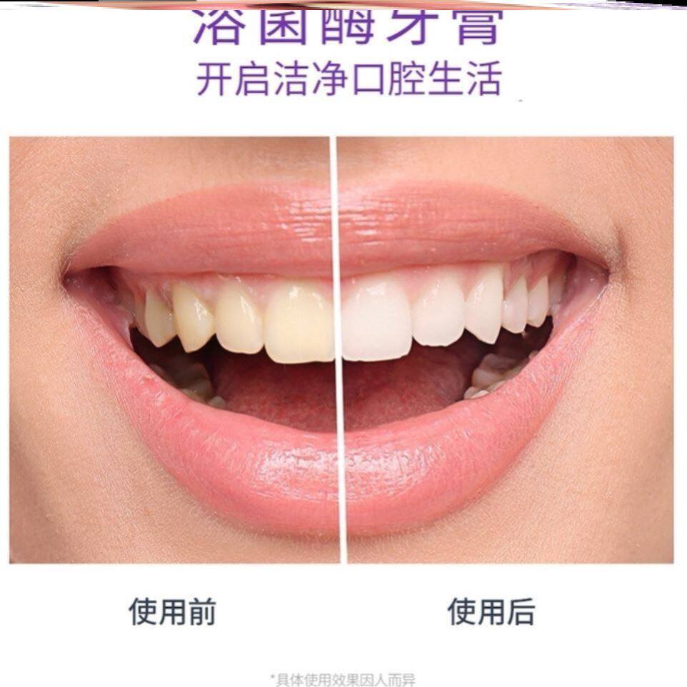 海莉韩熙牙膏绿标海利海丽东方白芨白净官方泊美牙膏