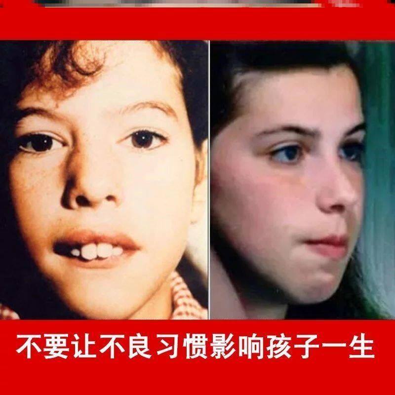 儿童睡觉张嘴呼吸纠正胶带夜晚防呼噜声封口软装墙贴