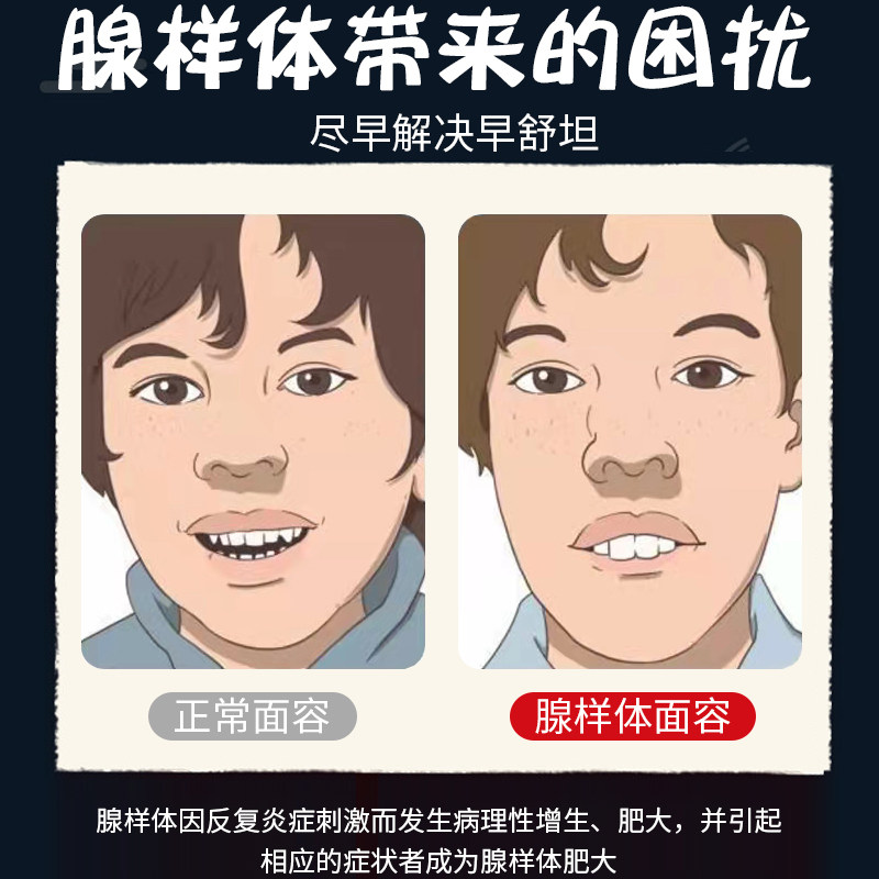 腺样肥大中药贴面面容矫正调理儿童扁桃体发炎洗鼻器吸鼻器