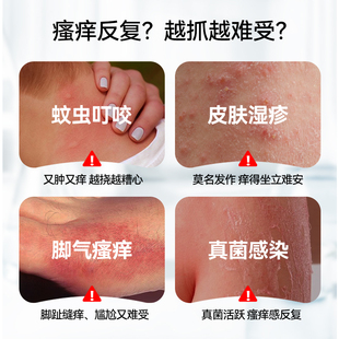 LAPOR断痒王皮肤瘙痒干痒止痒软膏全身痒温和抑菌B
