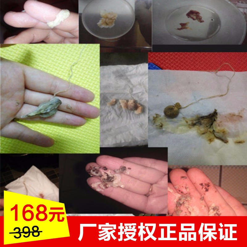 清宫丸排出白皮的照片图片