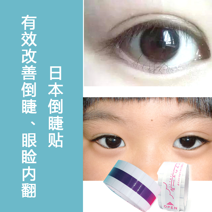日本倒睫毛矫正眼贴倒睫毛儿童小孩倒睫毛胶带下睫毛倒睫胶布婴儿