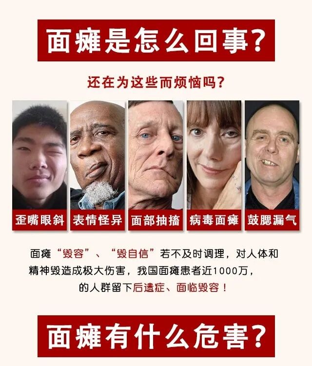 面瘫贴歪后遗症康复专用贴口眼面部牵正脸部神经保健护具护腰