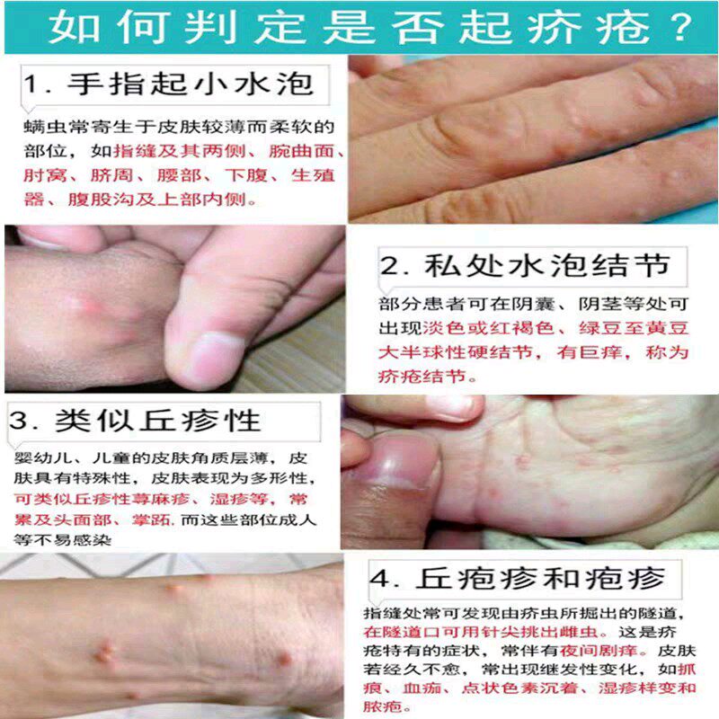 疥疮结节疥虫阴虱螨虫阴囊湿疹皮肤瘙痒止痒动物保健品