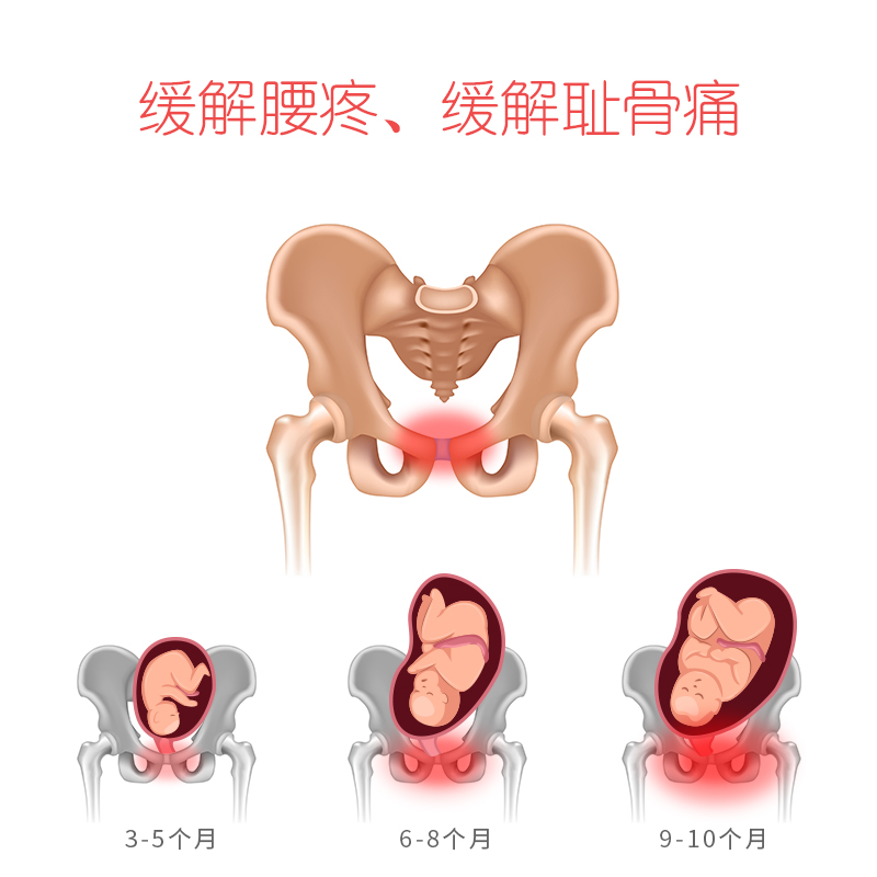 孕早期耻骨痛图片