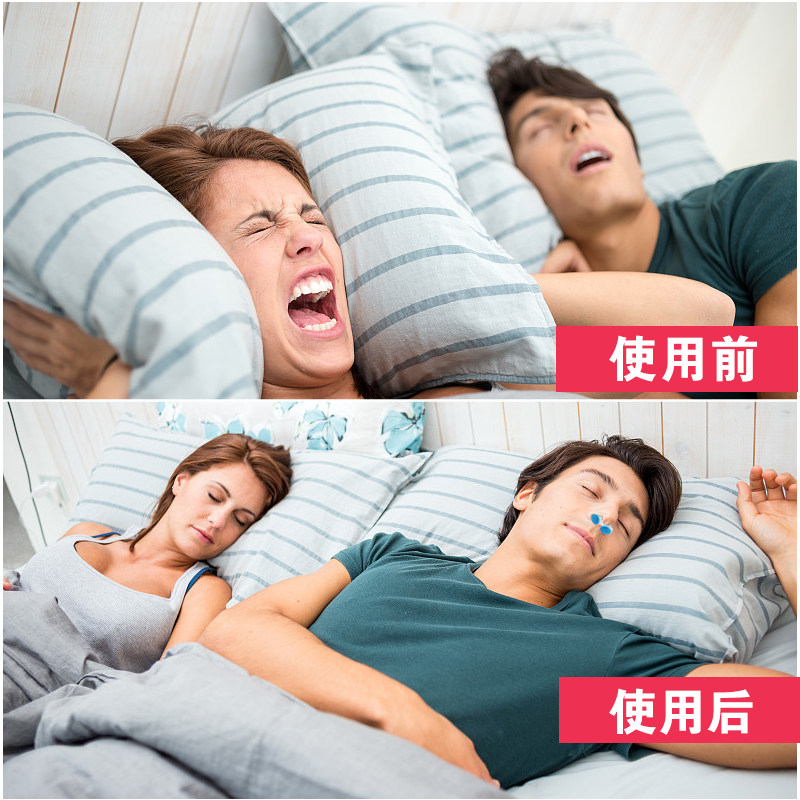 止鼾器防止睡觉打呼噜打鼾神器张鼻腔鼻孔呼噜消鼻塞止酣器