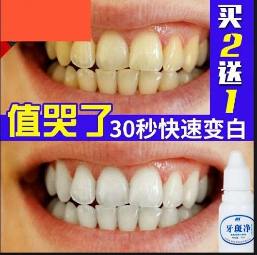 快速去除氟斑速效神器使黄牙齿变白牙齿美白脱色剂