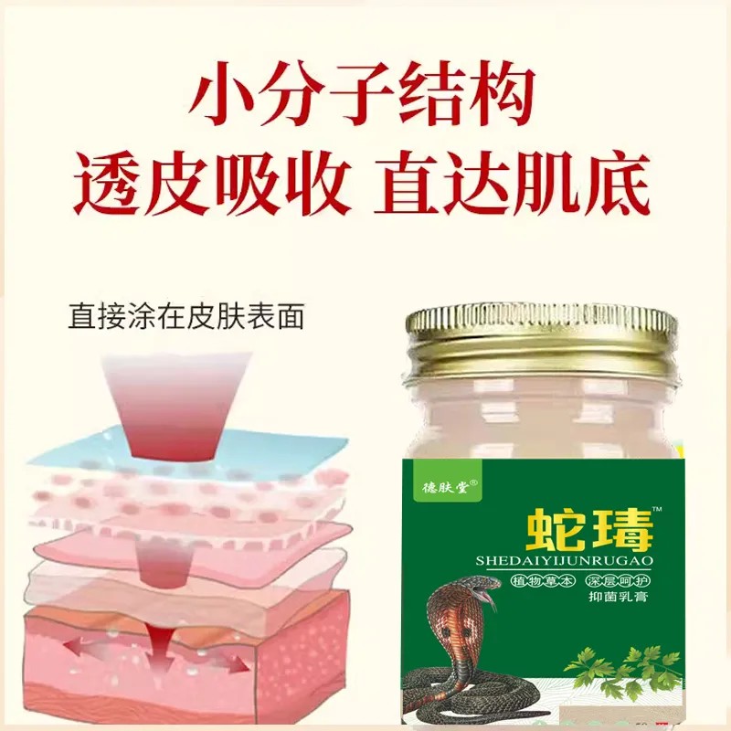 外用抑菌红斑软膏正品皮肤百草止痒王全身痒湿疹狼毒止痒王