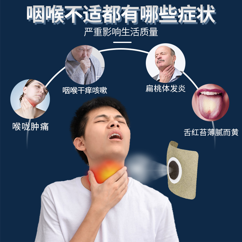 慢性咽扁专用康专用肿根咽喉炎肥大扁桃体贴滤穴位膏药贴器械