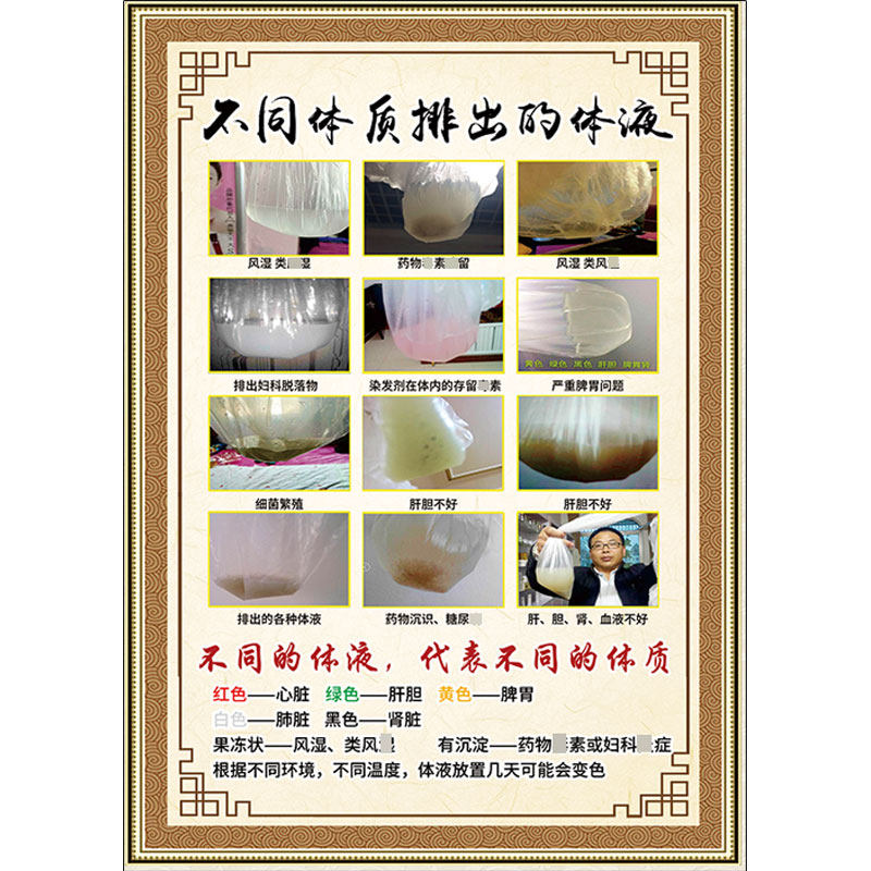 包邮沙棘养生海报排酸排毒宣传挂画活动广告体液汗液对应症状展板
