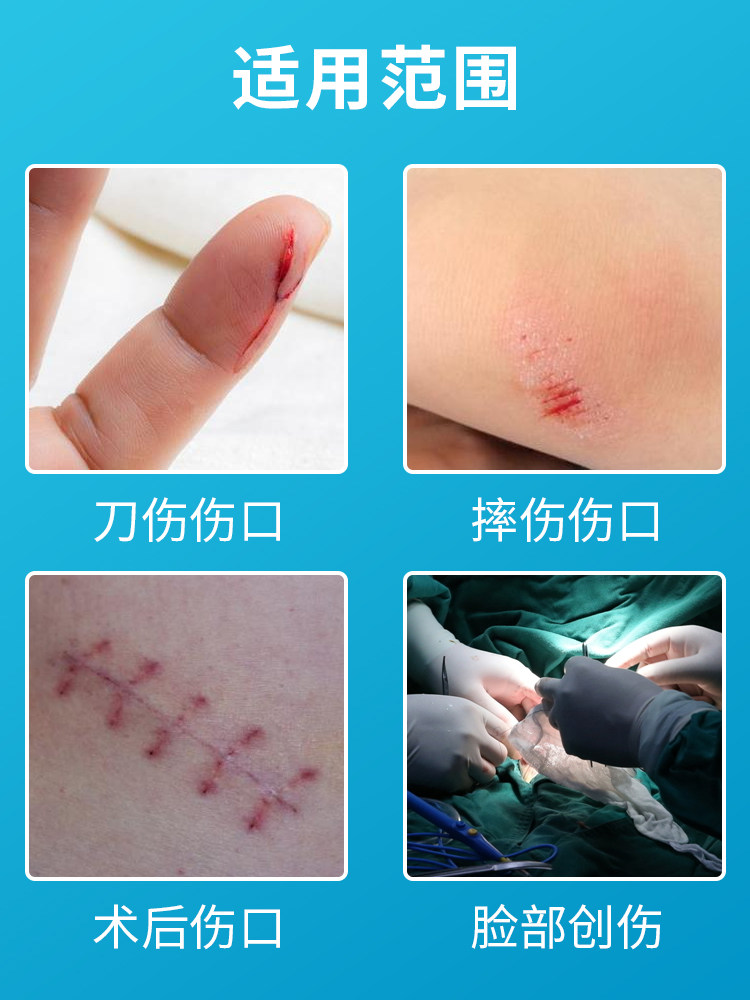 疤痕医用张贴减张拉链链式创口贴免缝合伤口创口贴