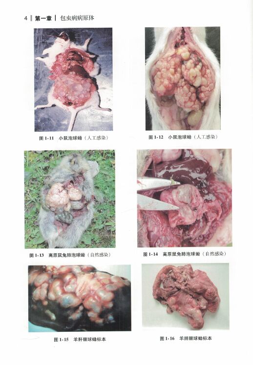 正版现货 包虫病影像诊断图谱(精装彩图)唐桂波主编 人民卫生出版社