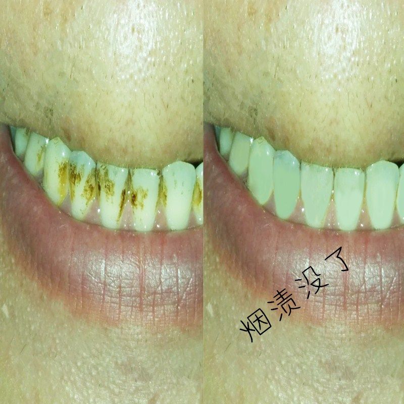 小红推荐白人更美烟渍茶渍牙粉牙白神器去黄漱口水