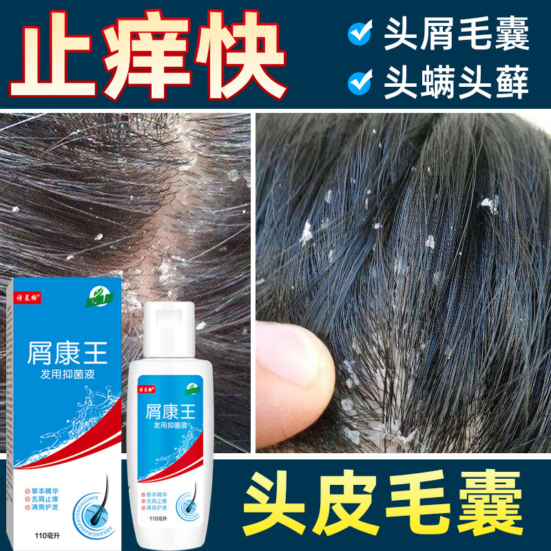 康王正品去屑止痒洗发水控油蓬松硅油男士螨虫皮肤消毒护理消