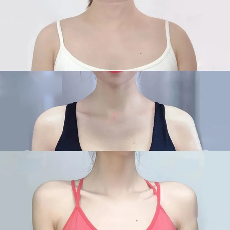 佰草世家直角一字肩瘦美背远离厚肩肩膀溜肩方肌纤体霜