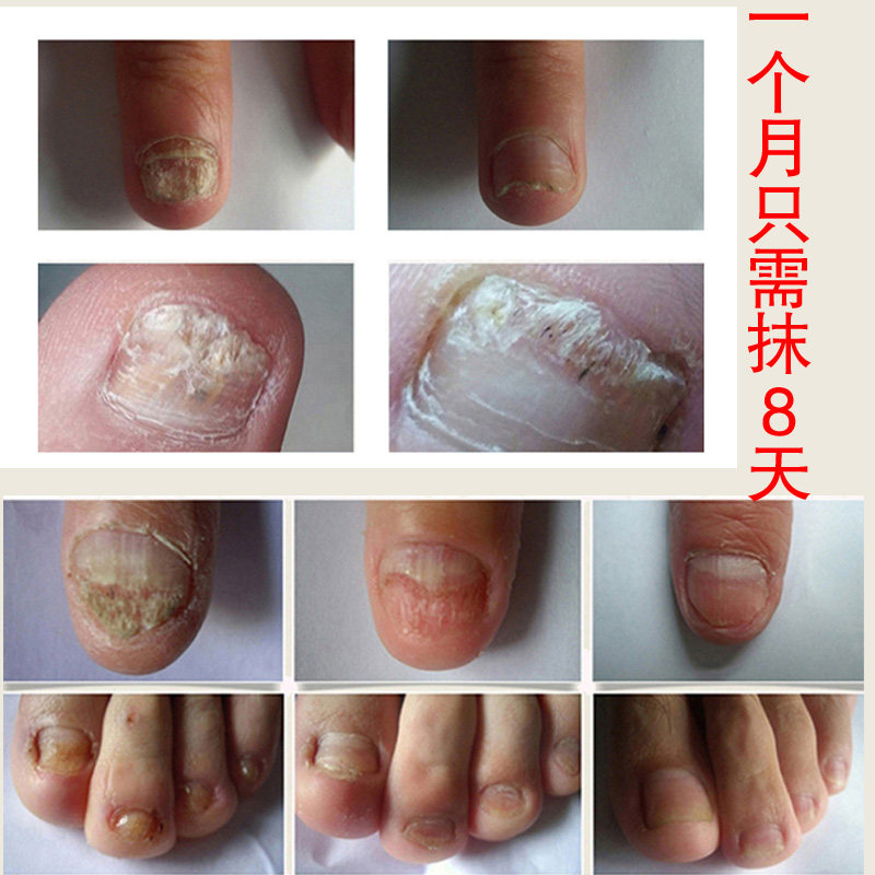 灰甲杨四郎神笔涂抹专用软甲去除增厚外用正品美甲工具