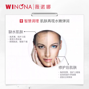 薇诺娜透明质酸保湿修护精华水补水锁水滋润改善角质层舒缓敏感肌