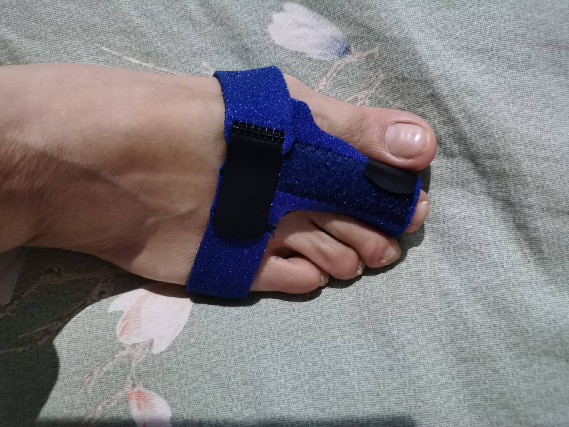 脚趾骨折石膏骨裂保护套可穿穿鞋其他固定器钢板保健护具护腰