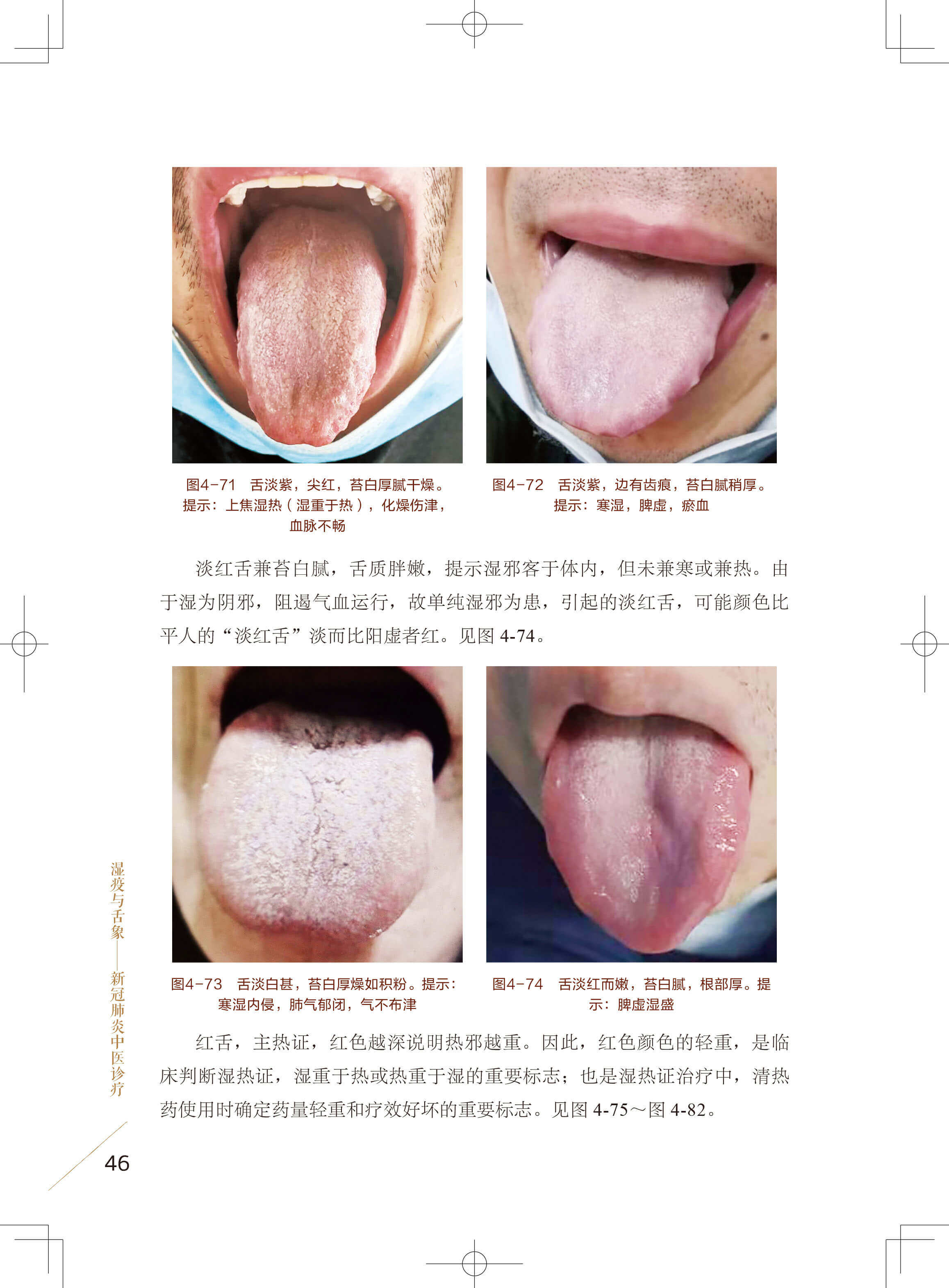 中医临床湿疫舌象调理图解秘舌平阳阴平养生中医