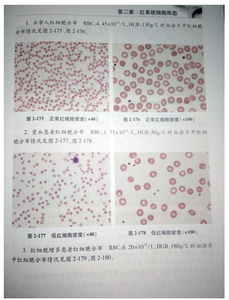 血象外周血细胞图谱张时民王庚主编可搭外周血细胞形态学检查技术人民