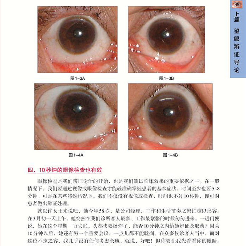 眼睛看病症大全图解图片