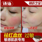 特效去红血丝修复祛除脸皮肤过敏抗敏感肌