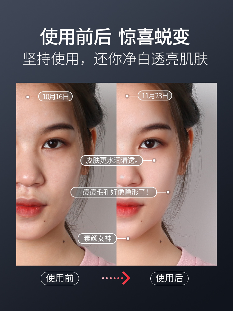 nanotime beauty instrument household face washing instrument facial cleansing massage pore cleansing face export and import equipment