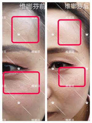 轻薄,透气,先睡衣穿了一次,极具性感。后来想到外穿,当防晒衣妥妥的!大大提高穿搭率!! 轻薄,透气,先睡衣穿了一次,极具性感。后来想到外穿,当防晒衣妥妥的!大大提高穿搭率!!