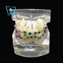 Dental Material Oral Teaching Model Crystal Misjaw Model With Support Nail Tooth Column