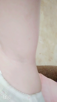 毛发比较多浓密，不好清洁，容易产生细菌，用脱毛膏来解决全身的毛问题，用了脱毛膏效果挺好，温和舒服，用了之后肌肤也美观滑嫩了，没有过敏现象，这样就放心了，不伤皮肤还美观， &nbsp;这款脱毛膏挺好用，很舒服不刺激皮肤，一分钱一分货，满意这个价格性价比蛮高的，值得购买