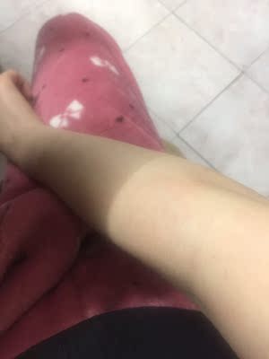 说说真相解说瑞宜激光脱毛仪怎么样，老司机评测是否好用？