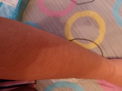 说说真相解说瑞宜激光脱毛仪怎么样，老司机评测是否好用？