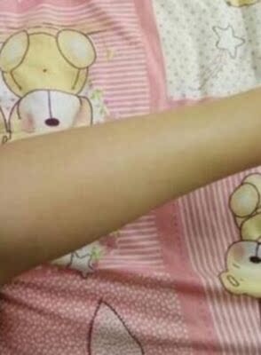 这款脱毛膏真的太好了，看朋友用别的脱毛膏脱毛贴感觉好痛流血了都，所以一直都不敢用，这次看评论都说不痛而我是那种敏感皮肤怕过敏，红痒，用过以后完全没有这个反应，可以放心使用，现在我手臂，大腿和腋下那些让人困扰的长毛全部都脱干净了，整个人都感觉清爽了很多。