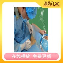 High-definition armpit odor body odor flip cutting method armpit sweat gland removal traditional armpit odor surgery(video)