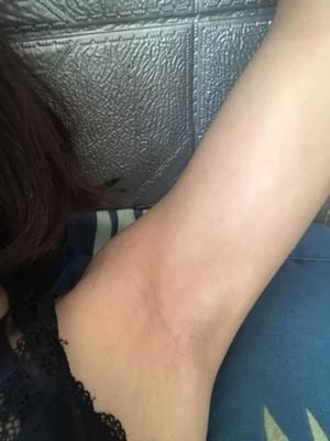 人生中 第一次尝试脱毛膏，很神奇，用了之后不仅腋下毛发没了，而且特别光滑，还变白了。以前总是不敢用，第一次使用很仔细的看完了说明书有图指导 其实还是很简单的，太谢谢您了。而且我是敏感皮肤，用了之后感觉挺好的。脱毛过程很轻松，不知不觉毛毛就掉了。舒缓水也挺滋润皮肤的，用完以后摸起来滑滑的。很棒。以后就放心用这家了。